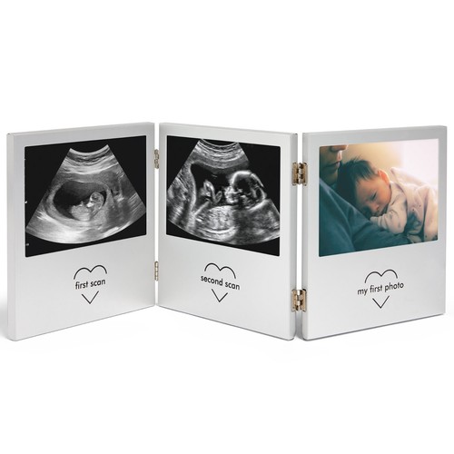 Baby scan photo frame - scan,